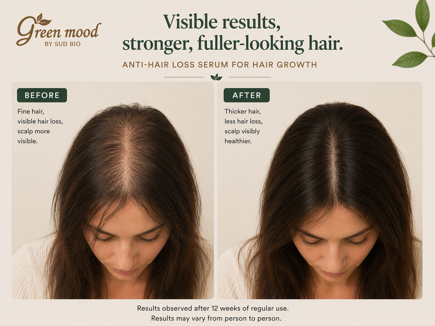 before after anti hair loss pack - green mood - stop hair falling and hair loss